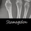 skamagedon